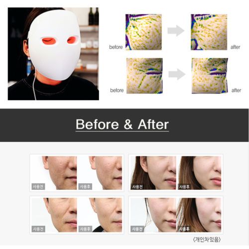 630 NM Red Light Face Mask