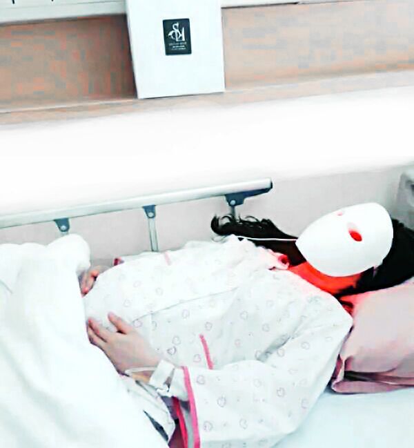 630 NM Red Light Face Mask